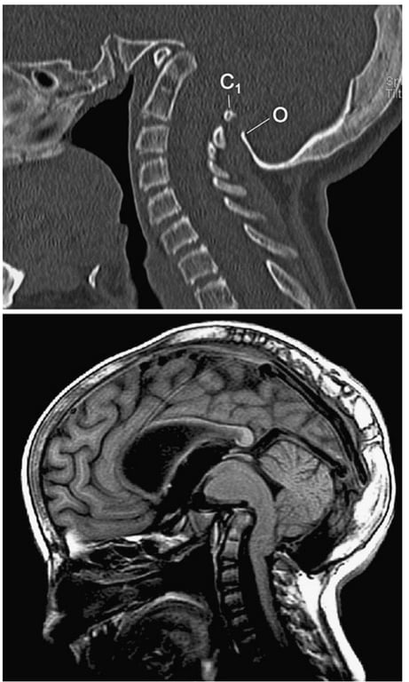 A close-up of a brain and a brain scan AI-generated content may be incorrect.