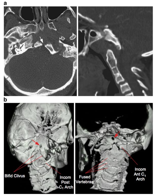 A close-up of a brain scan AI-generated content may be incorrect.