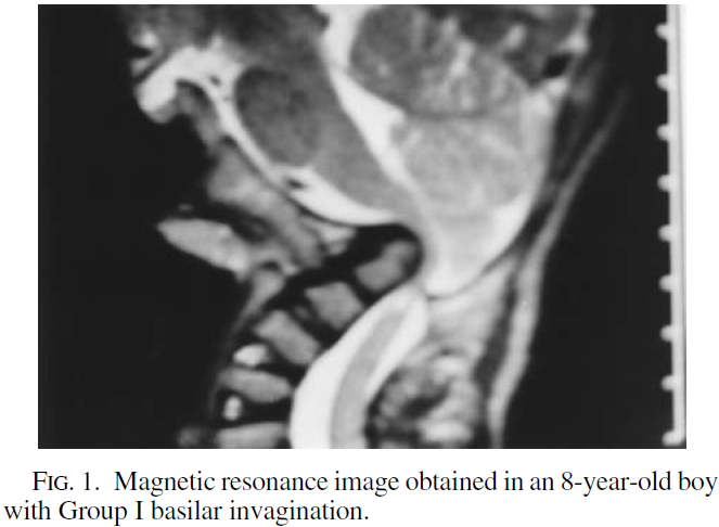 A close-up of an x-ray AI-generated content may be incorrect.