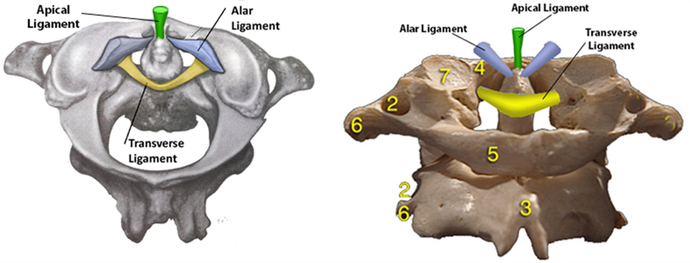 Apical Ligament Alar Ligament Transverse Ligament Alar Ligament Apical Ligament Transverse Ligament 