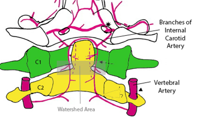 Cl Branches of Internal Carotid Artery Vertebra I Artery IVatershed Area 