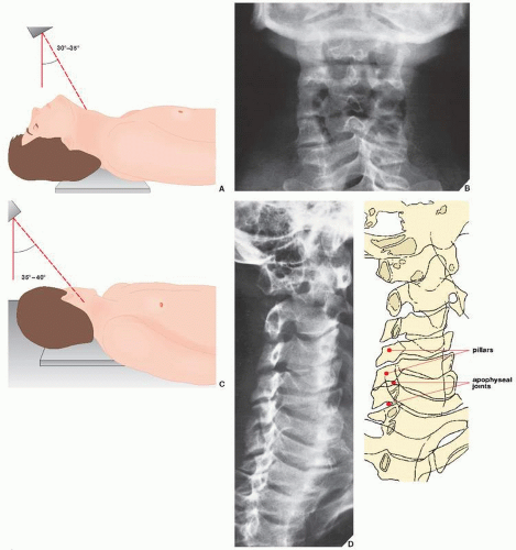Spine | Radiology Key