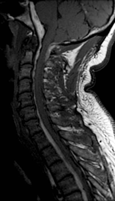 A close-up of a mri scan AI-generated content may be incorrect.