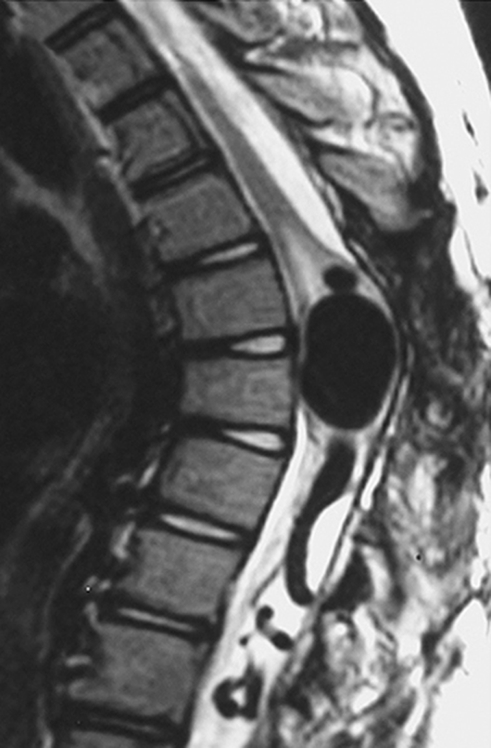 A close-up of a mri scan AI-generated content may be incorrect.