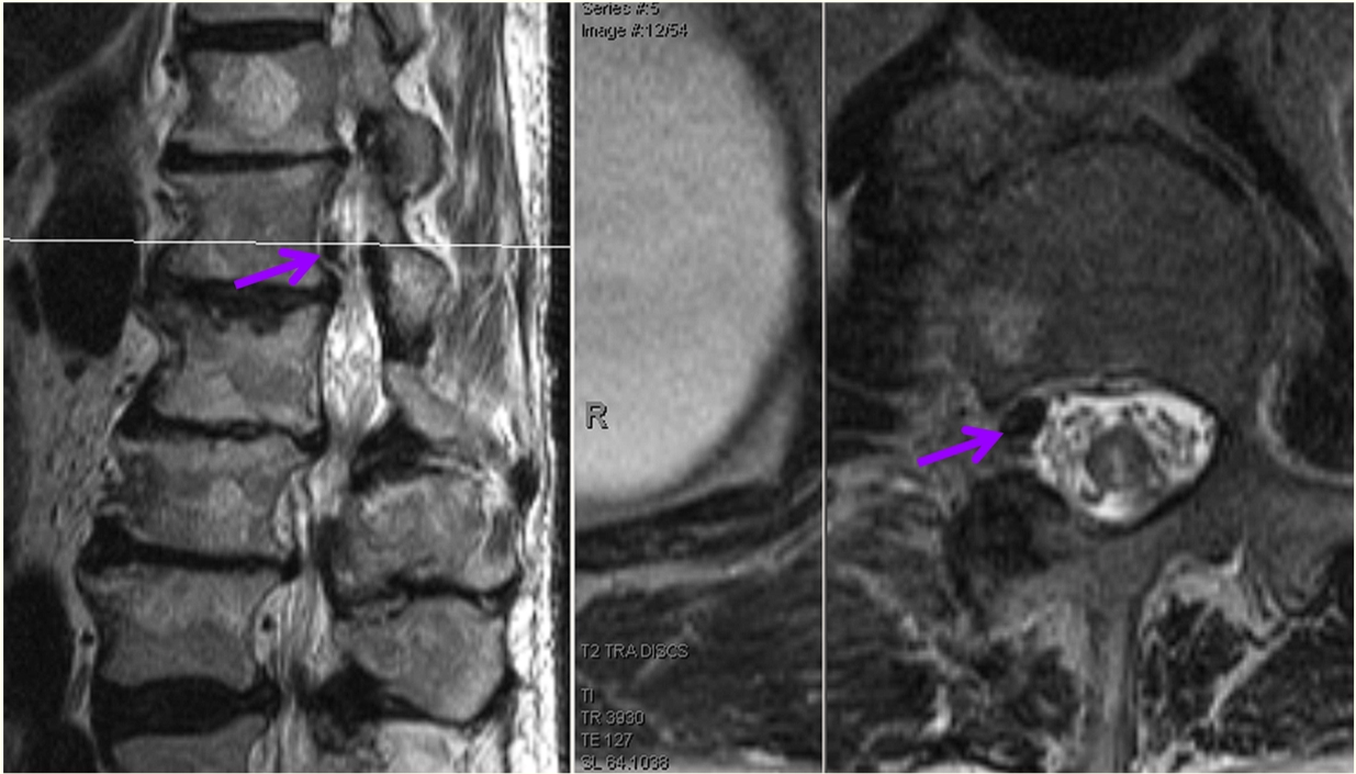 A close-up of an mri AI-generated content may be incorrect.