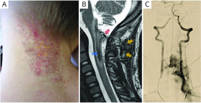 A close-up of a person's neck AI-generated content may be incorrect.