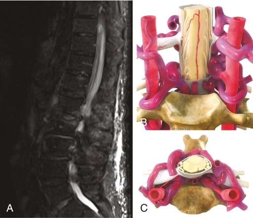 A close-up of a spine AI-generated content may be incorrect.