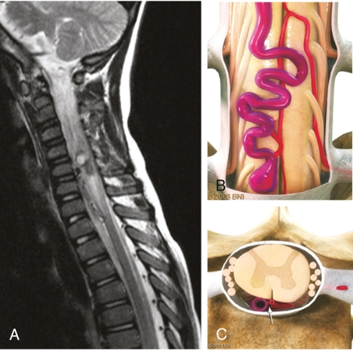 A close-up of a spine AI-generated content may be incorrect.
