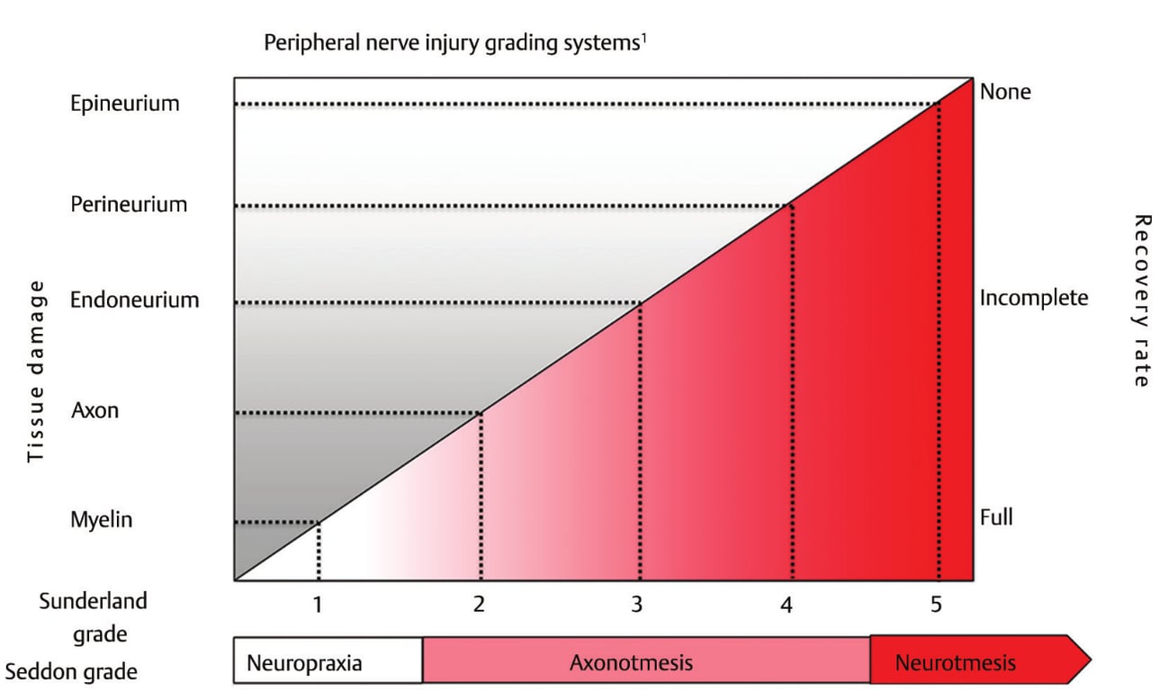 Peripheral nerve injury grading systemsl Epineurium Perineurium Endoneurium Axon Myelin Sunderland grade Seddon grade 2 4 None Incomplete Full 5 Neuropraxia 3 onotmes• 