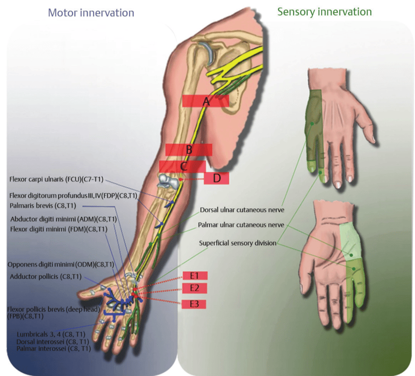 Ulnar nerve ([C7], C8, T1)