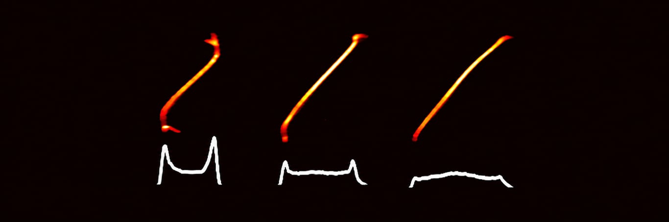 Experimental Demonstration of Double Emittance Exchange toward Arbitrary Longitudinal Beam Phase-Space Manipulations