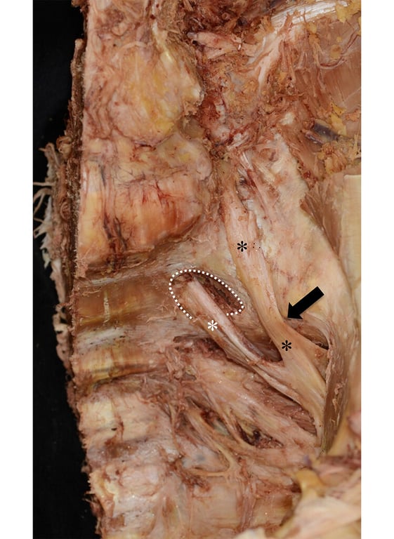 Photograph of the dissected left pelvis. 