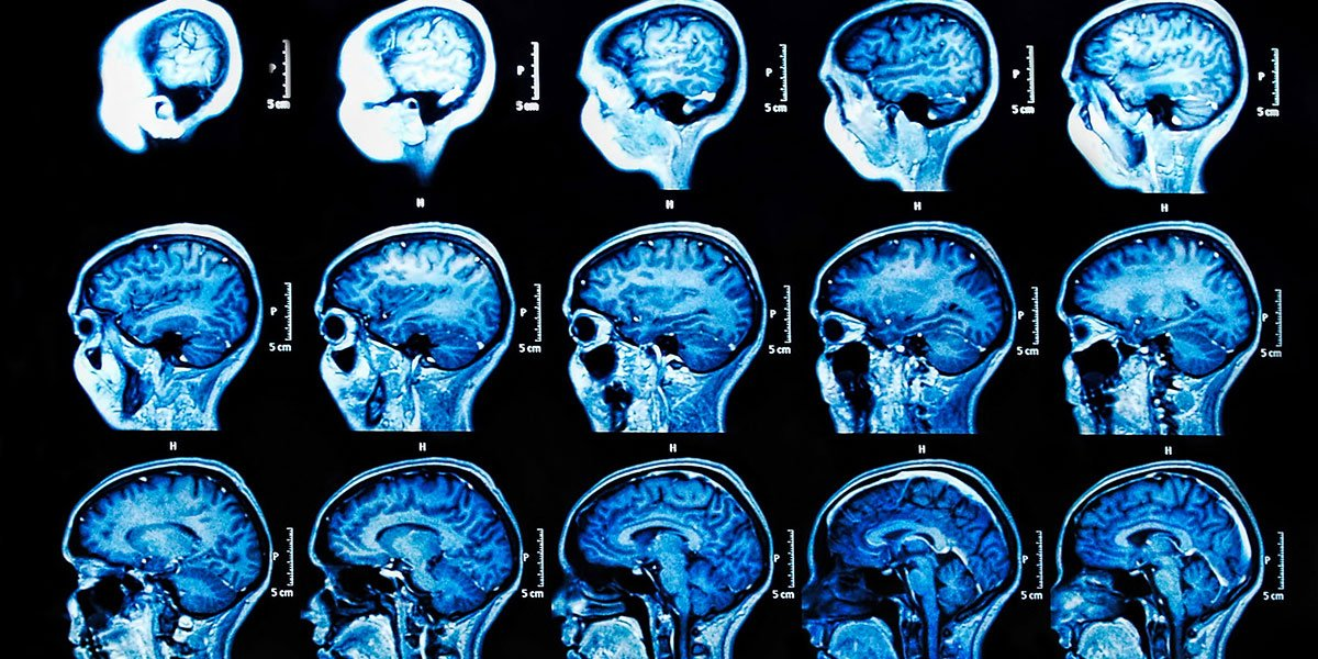 Part One: Cognitive Neuroscience