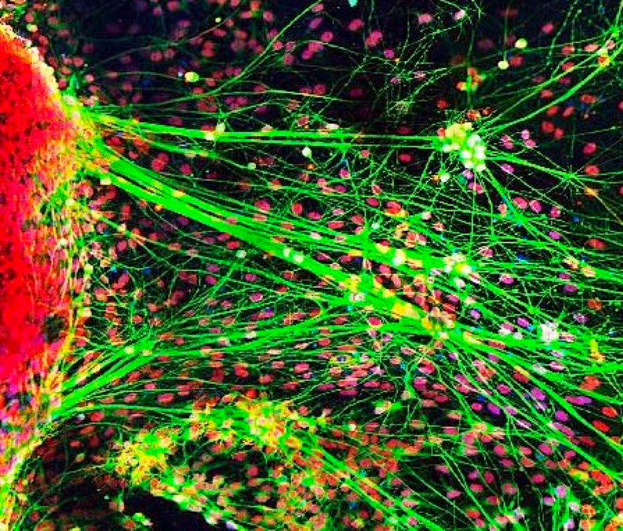 Stem Cells Have a Public Image Problem