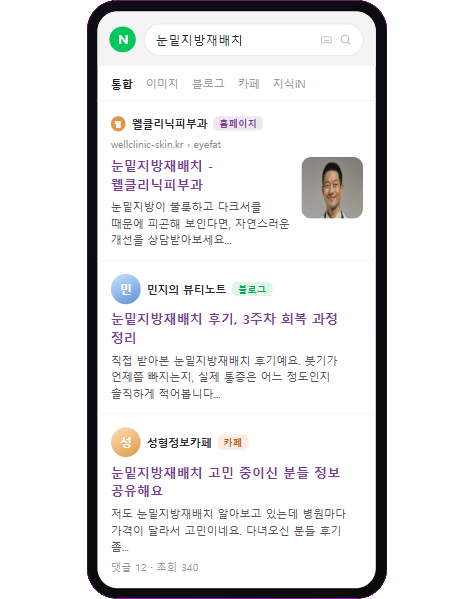 notion image