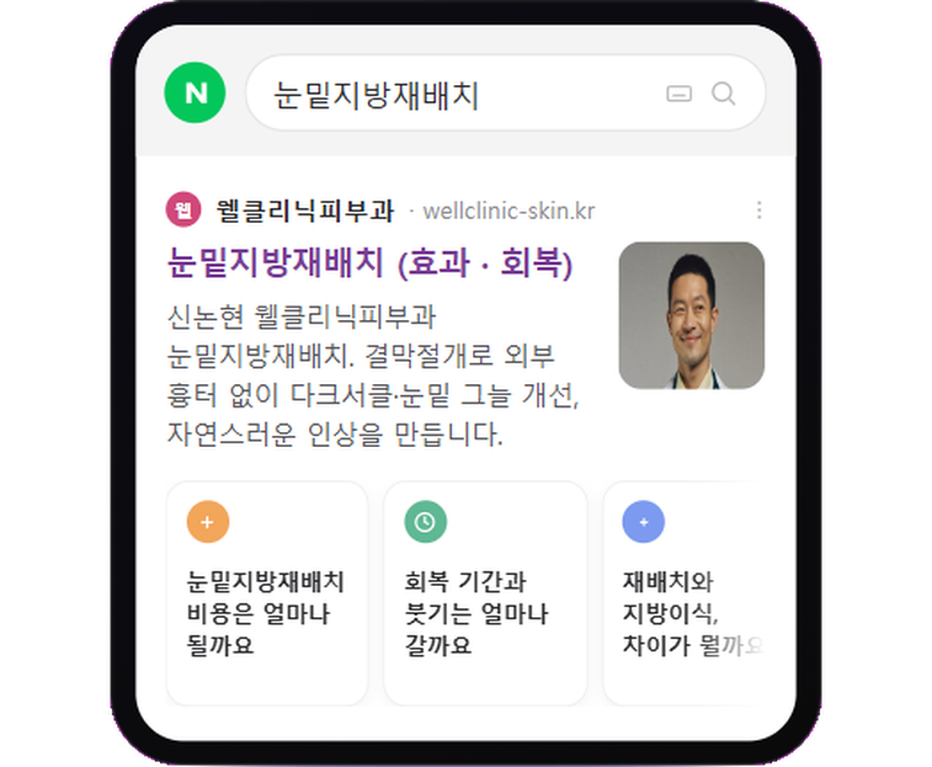 notion image