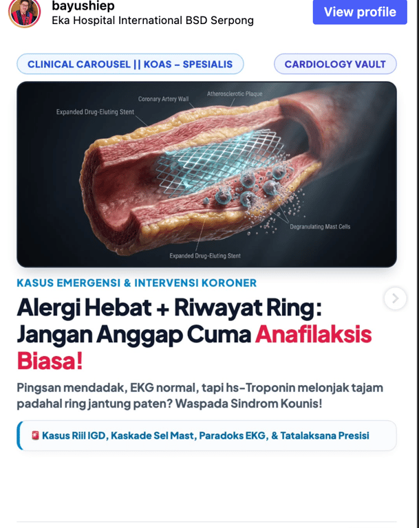 Alergi Hebat + Riwayat Ring: Jangan Anggap Cuma Anafilaksis Biasa!