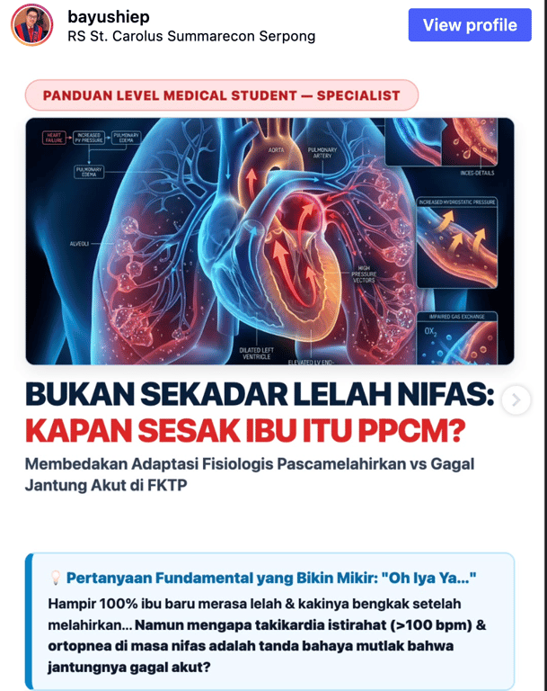 Bukan Sekadar Lelah Nifas: Kapan Sesak Ibu Itu PPCM?