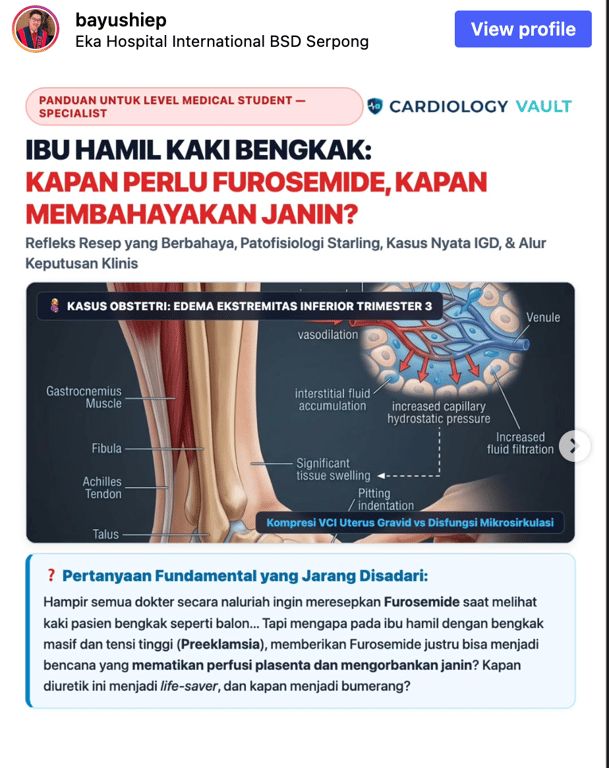 Ibu Hamil Kaki Bengkak: Kapan Perlu Furosemide, Kapan Membahayakan Janin?