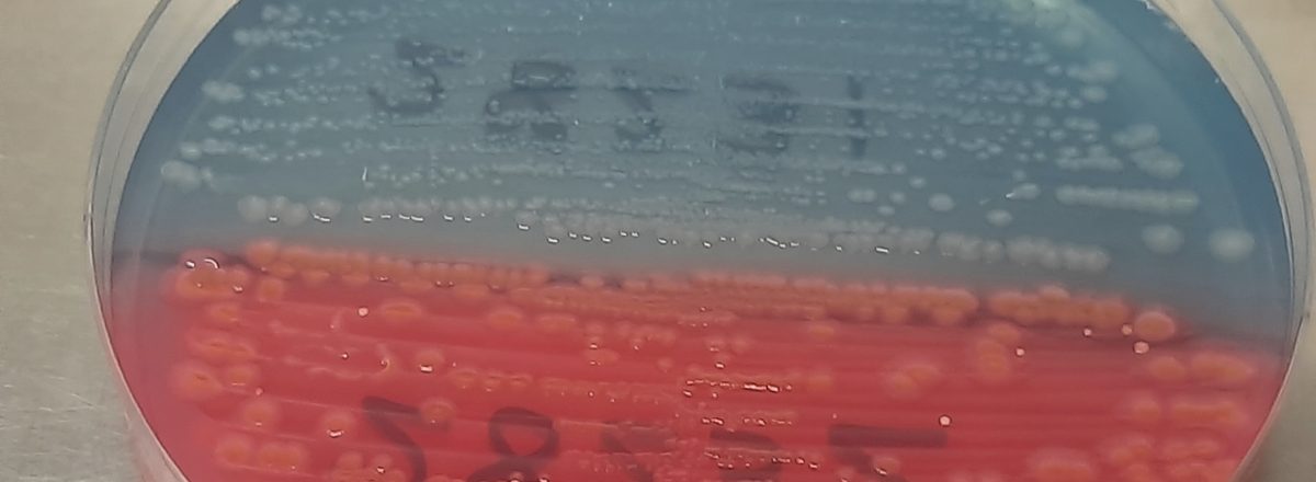 notion image
