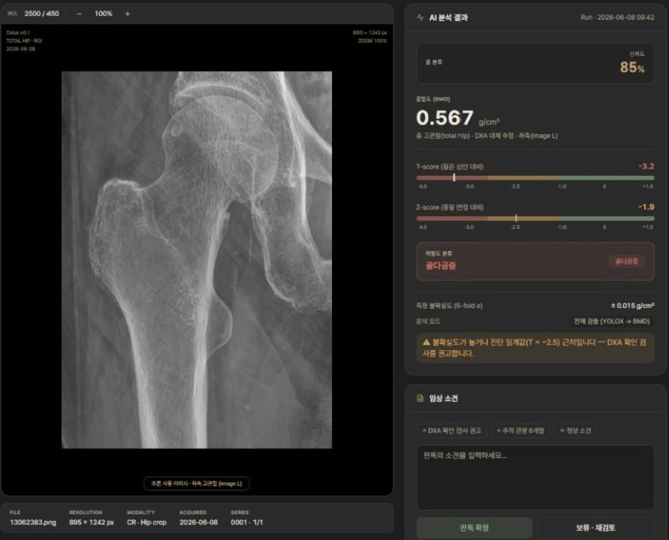 notion image