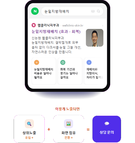 notion image