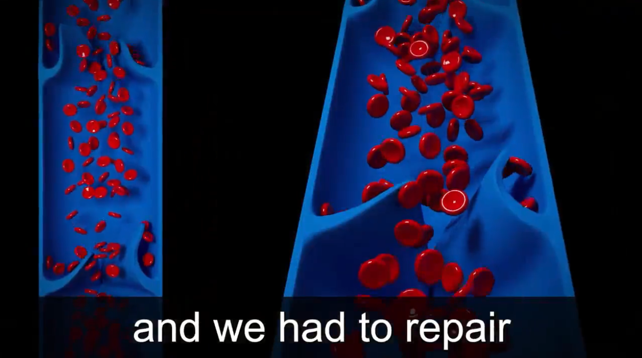 Lymph Savior (Two Second Edema Flush) (Edema) 