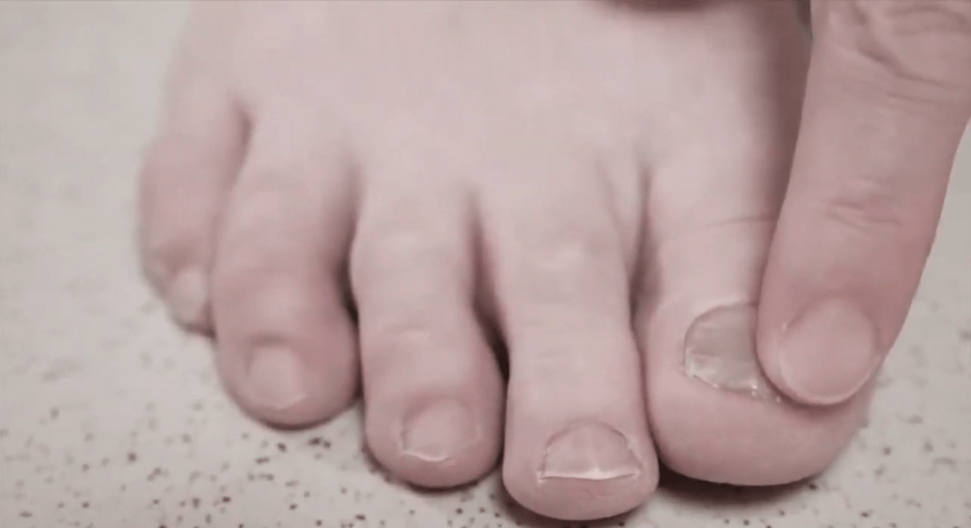 Despertar Antifúngico (Drink Antifúngico)