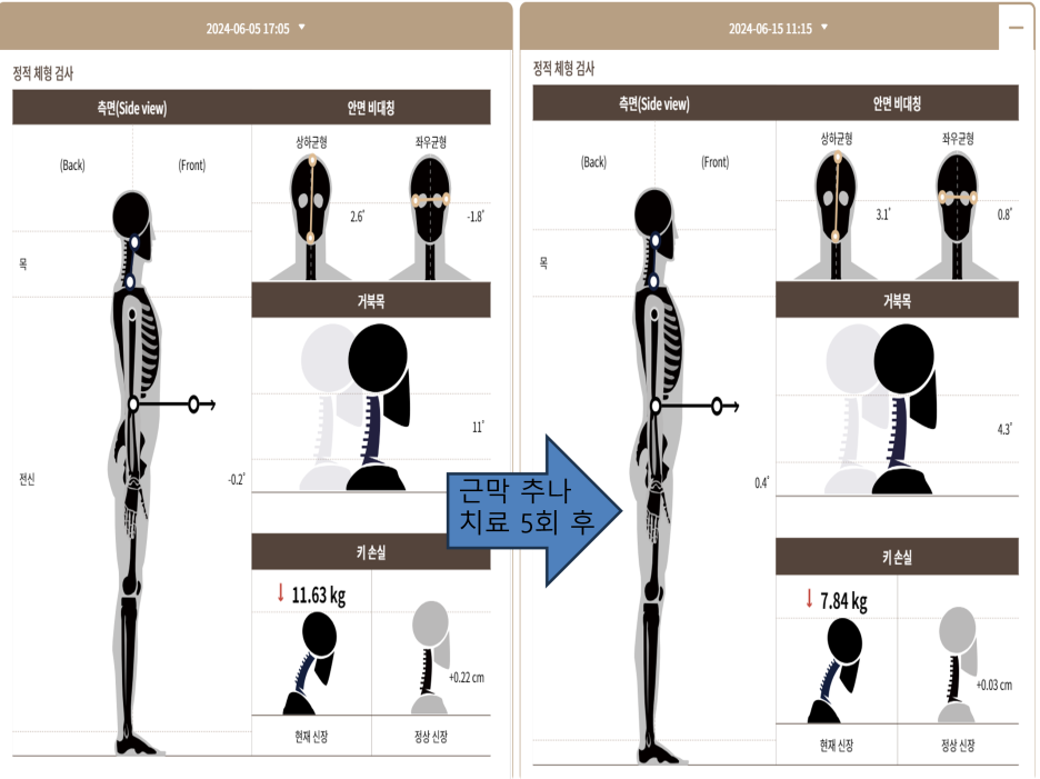 notion image
