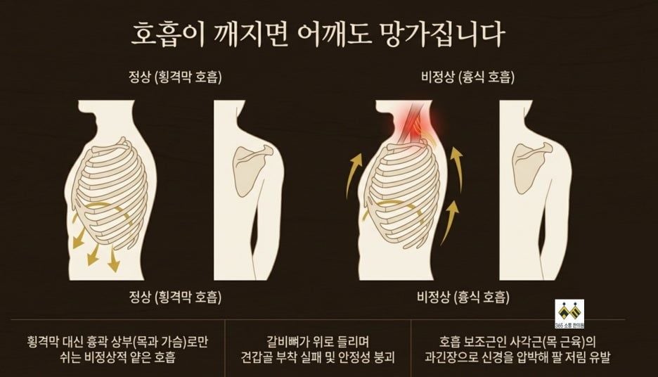 notion image