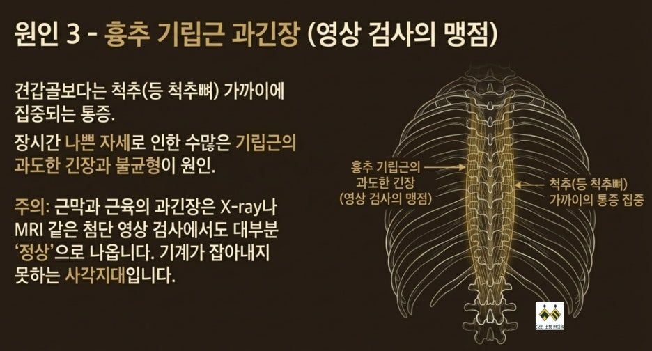 notion image
