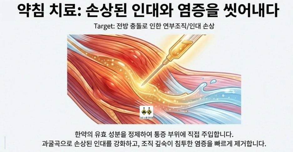 notion image