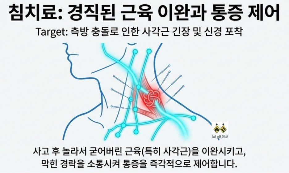 notion image