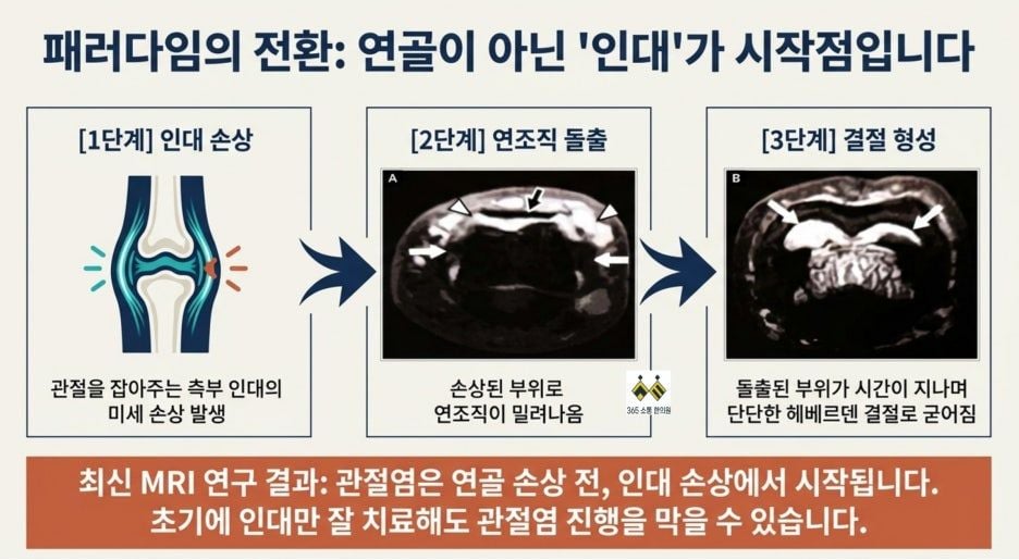 notion image