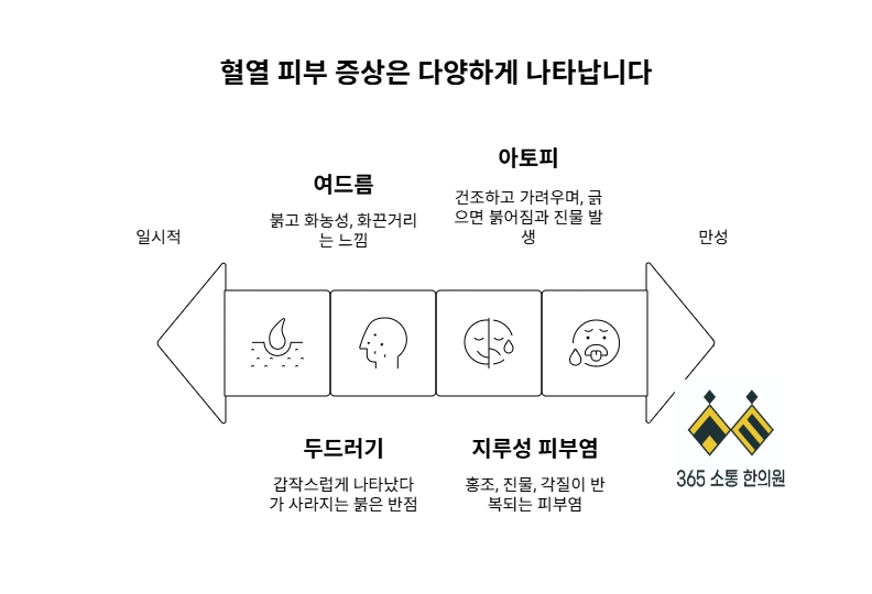 notion image