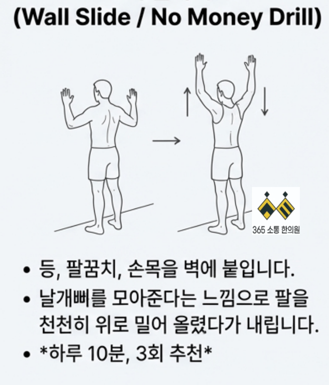 notion image