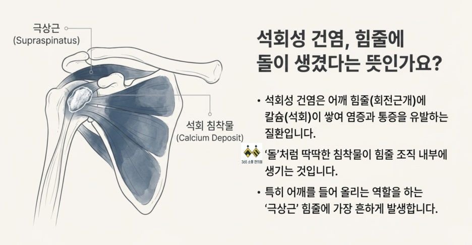notion image