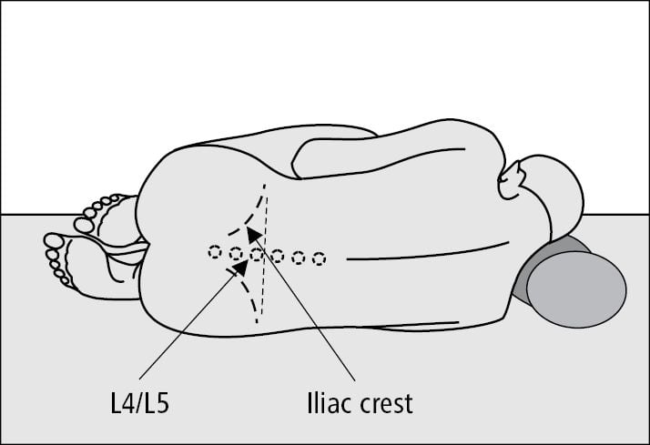 Appropriate patient positioning for lumbar puncture ... | GrepMed