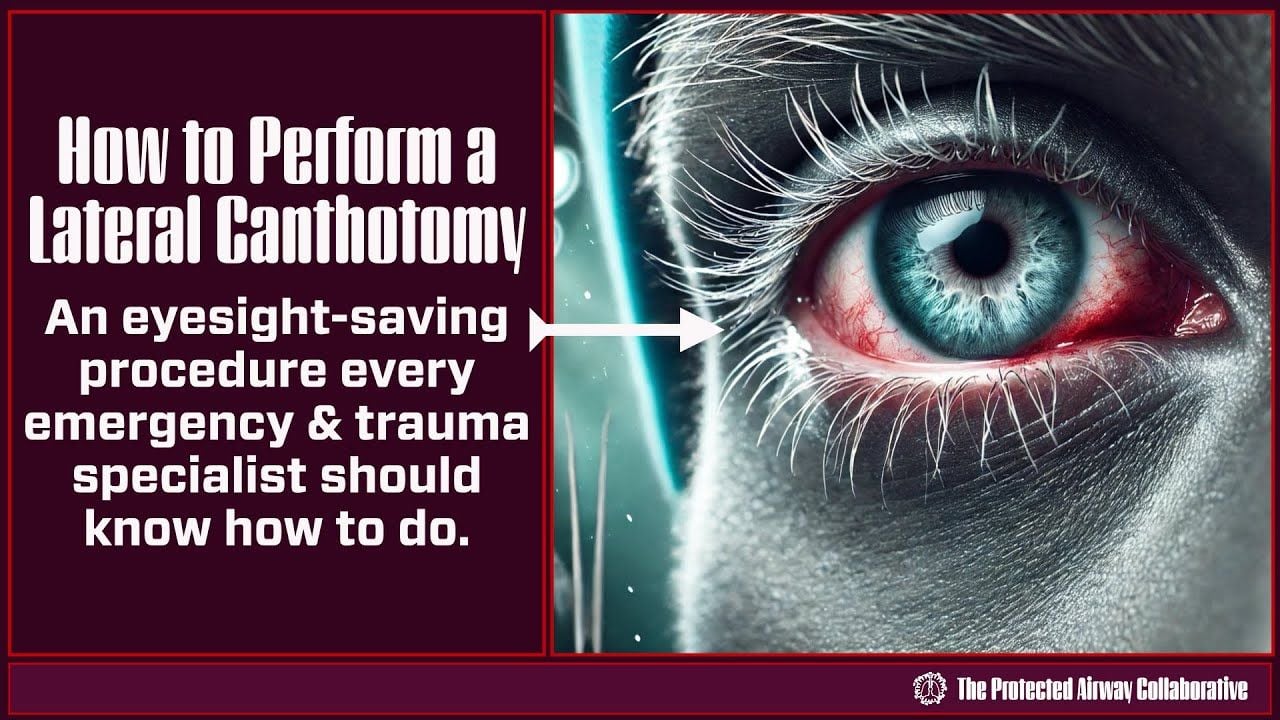 How to Perform a Lateral Canthotomy: An Eye-Saving Procedure Every Emergency Physician Should Know
