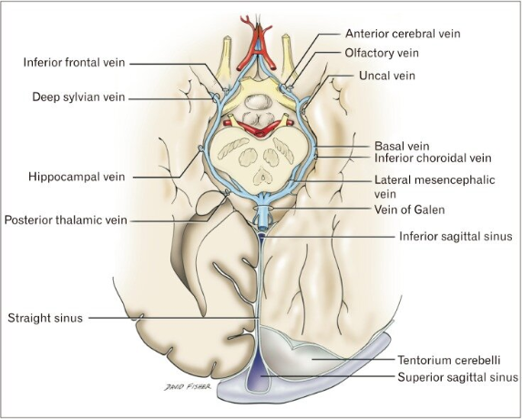 Drainage of the basal vein of Rosenthal into the confluence of sinuses ...
