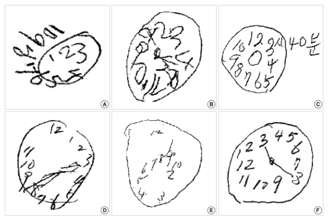 시계 그리기 검사, 출처 대한치매학회