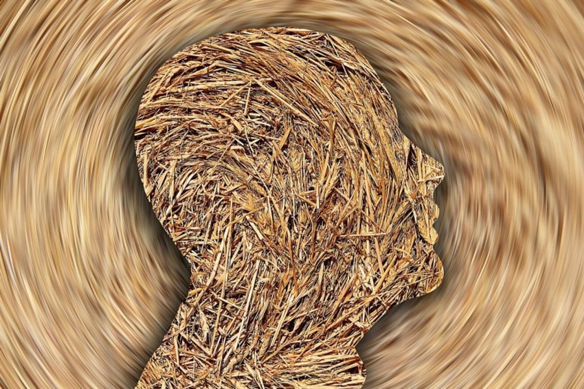 notion image