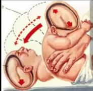 Nonaccidental Injuries (NAI)