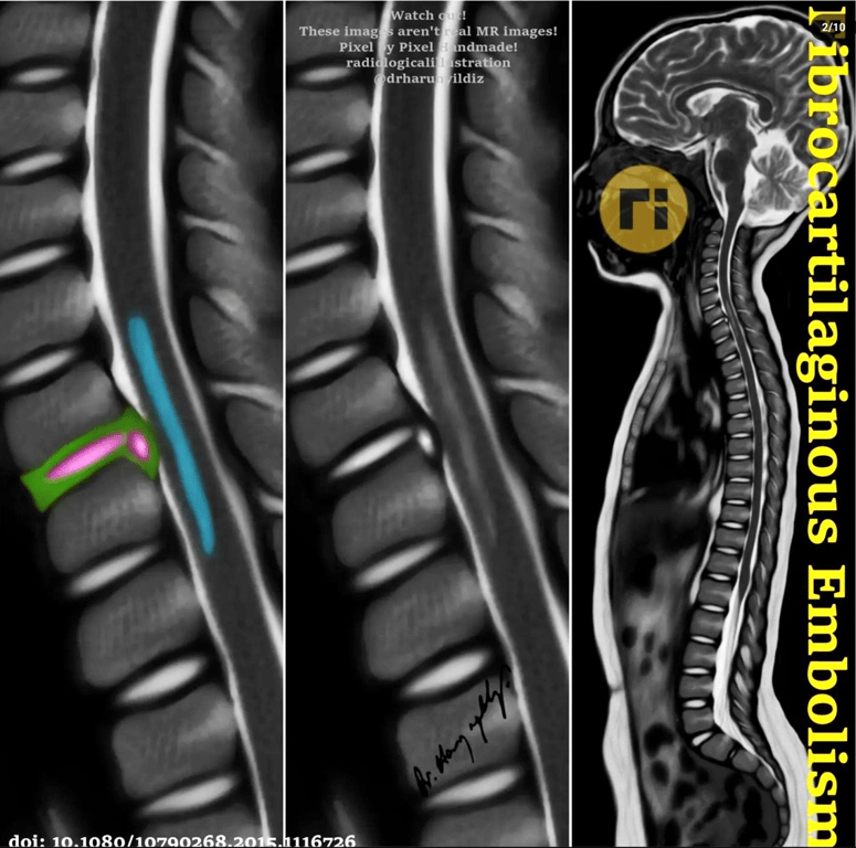 by https://x.com/drharunyildiz/status/1449972866552901633