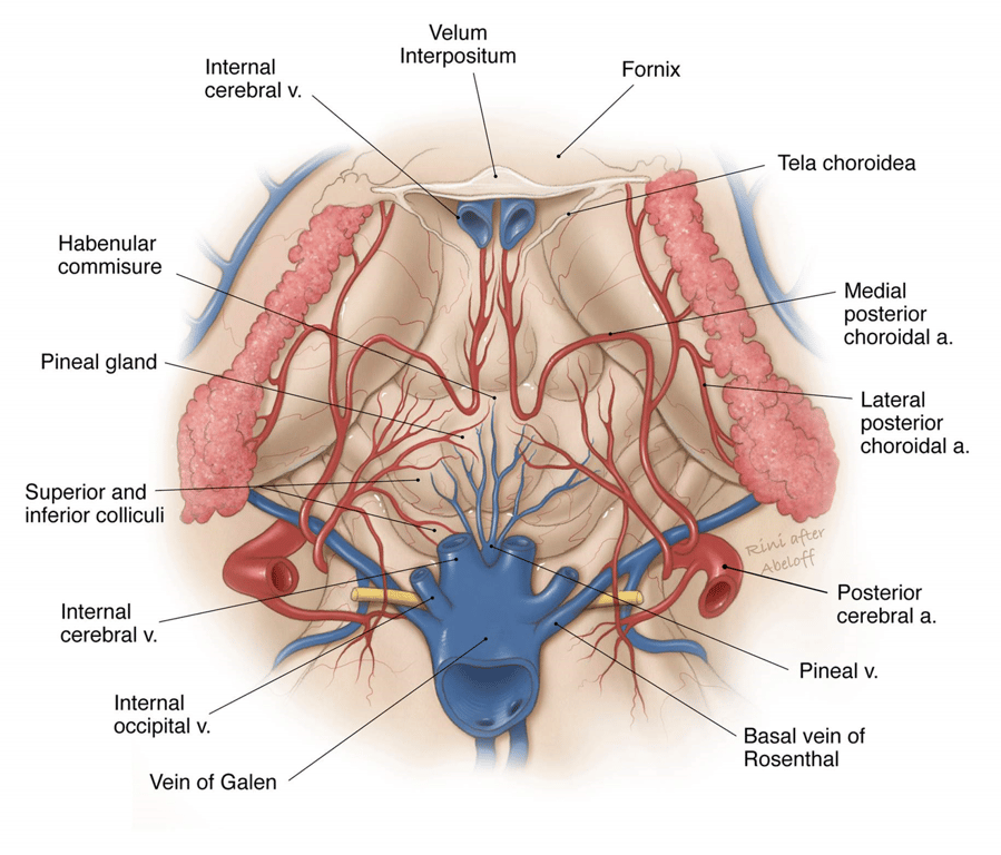 In this picture the MPCA and LPCA are coming from the same artery, this is not correct. Most pt have these two artery arising from the PCA separately