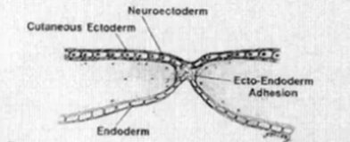 an accessory neurenteric canal (fistula) may begin as an ecto-endodermal adhesion where the two germ layers are in virtual contact in the midline. The midline neuroectoderm is thus bisected to give two hemineural plates.