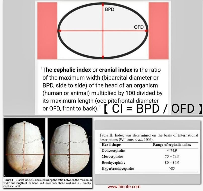 Normal range 74-83
Measurements, such as occipito-frontal-circumference may not be abnormal even in the face of a deformed skull shape