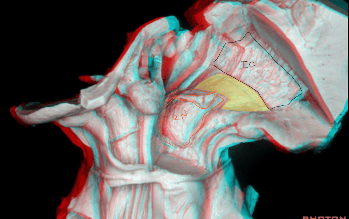 Posterior view of the diencephalic area.