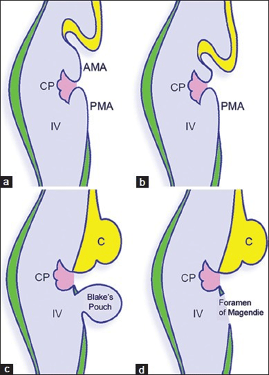 AMA: Anterior membranous area, C: Cerebellum, CP: Choroid plexus, IV: Fourth ventricle, PMA: Posterior membranous area.