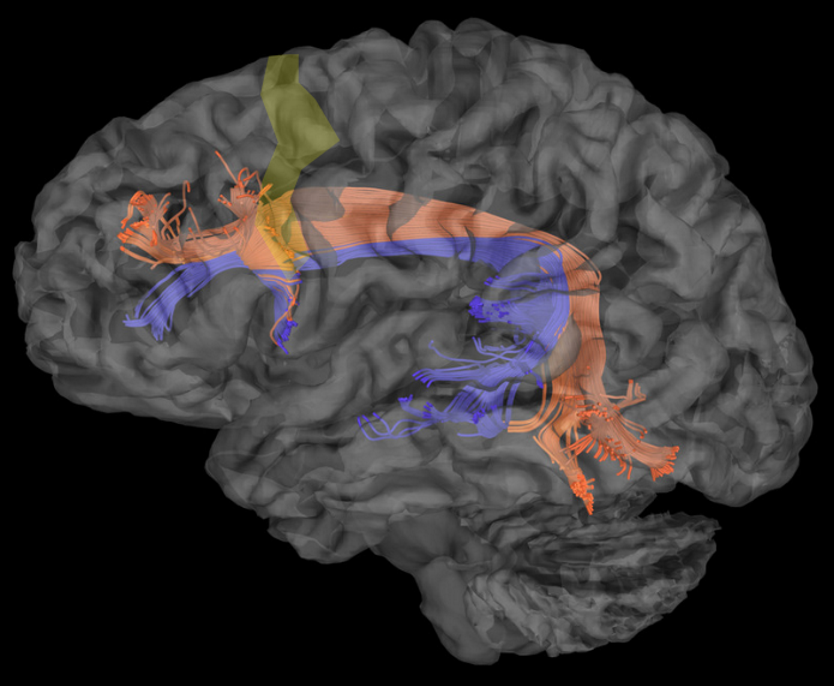 Precentral gyrus